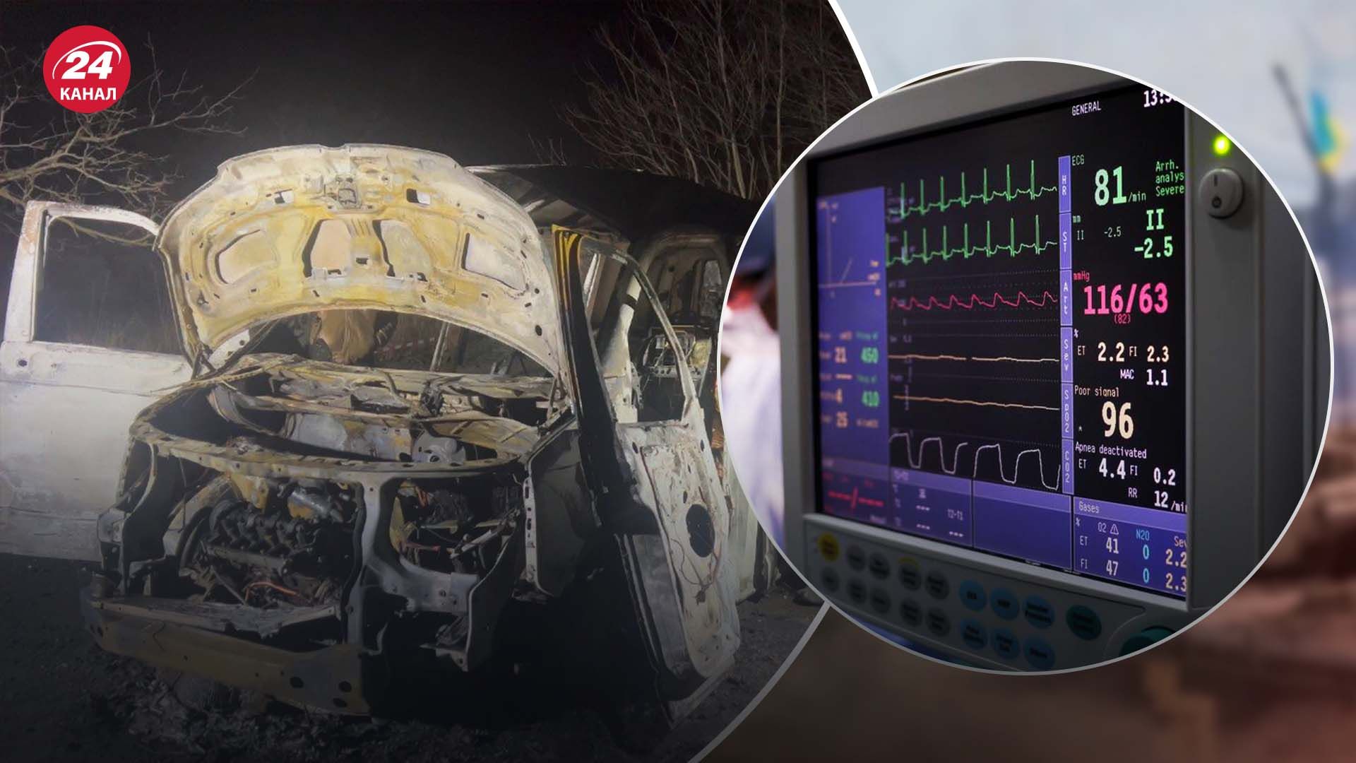 Поранені внаслідок вибуху представники УДА у важкому стані Поранені внаслідок вибуху представники УДА у важкому стані