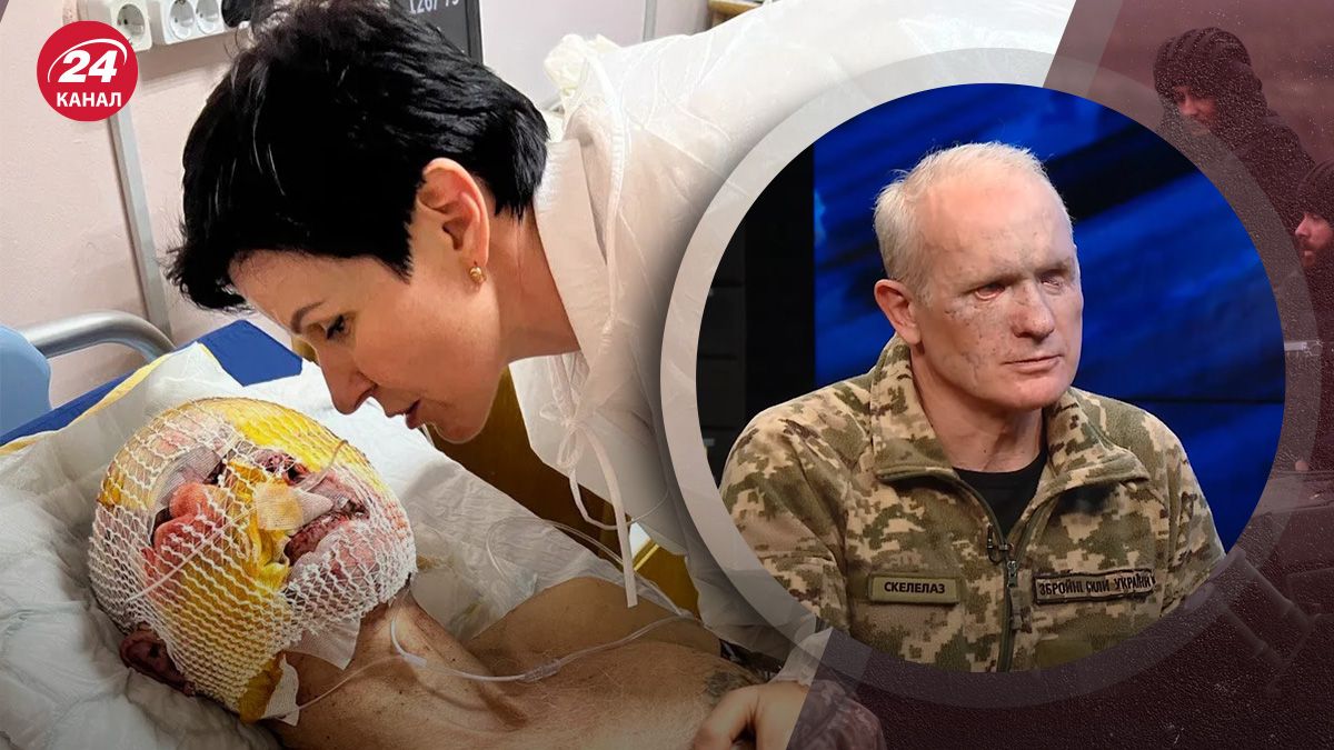 Історія Олега Гринченка – чому воїн ЗСУ повернувся на фронт після важкого поранення - 24 Канал Історія Олега Гринченка – чому воїн ЗСУ повернувся на фронт після важкого поранення - 24 Канал