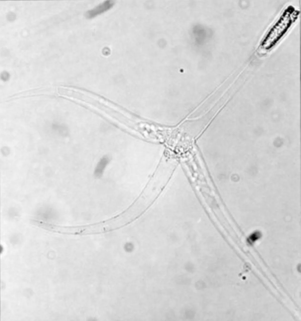 Изображение одного из видов Myxozoa