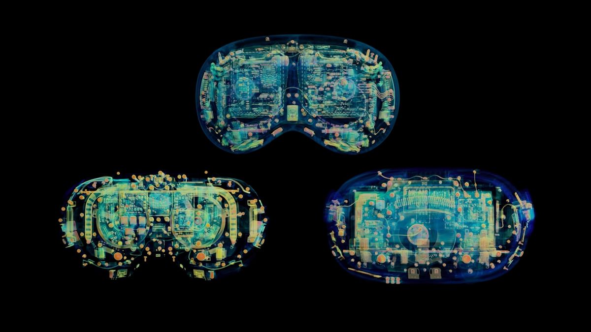Apple Vision Pro показали на скануваннях томографа Apple Vision Pro показали на скануваннях томографа