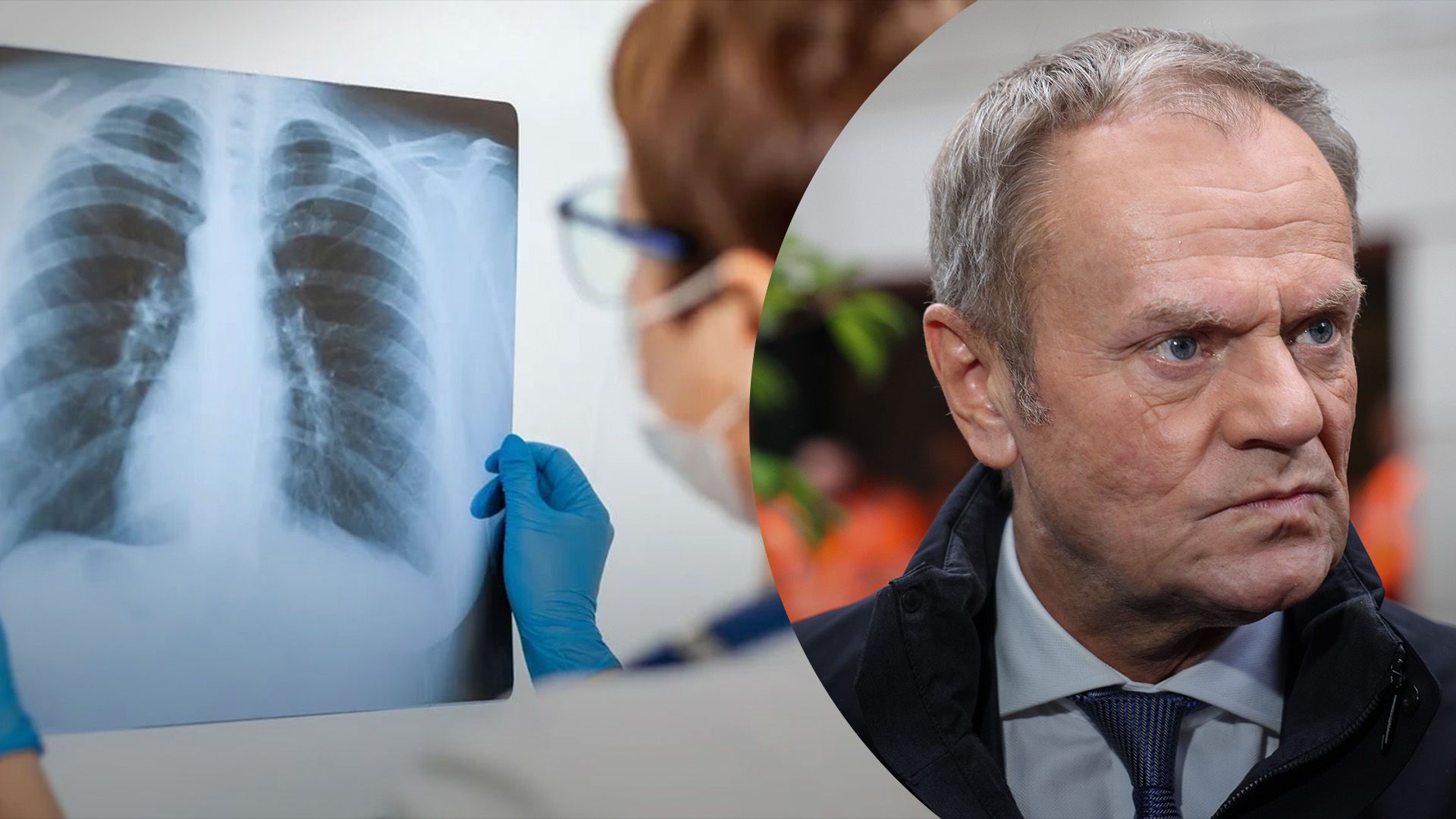 Дональд Туск прекратил публичную активность из-за пневмонии Дональд Туск прекратил публичную активность из-за пневмонии