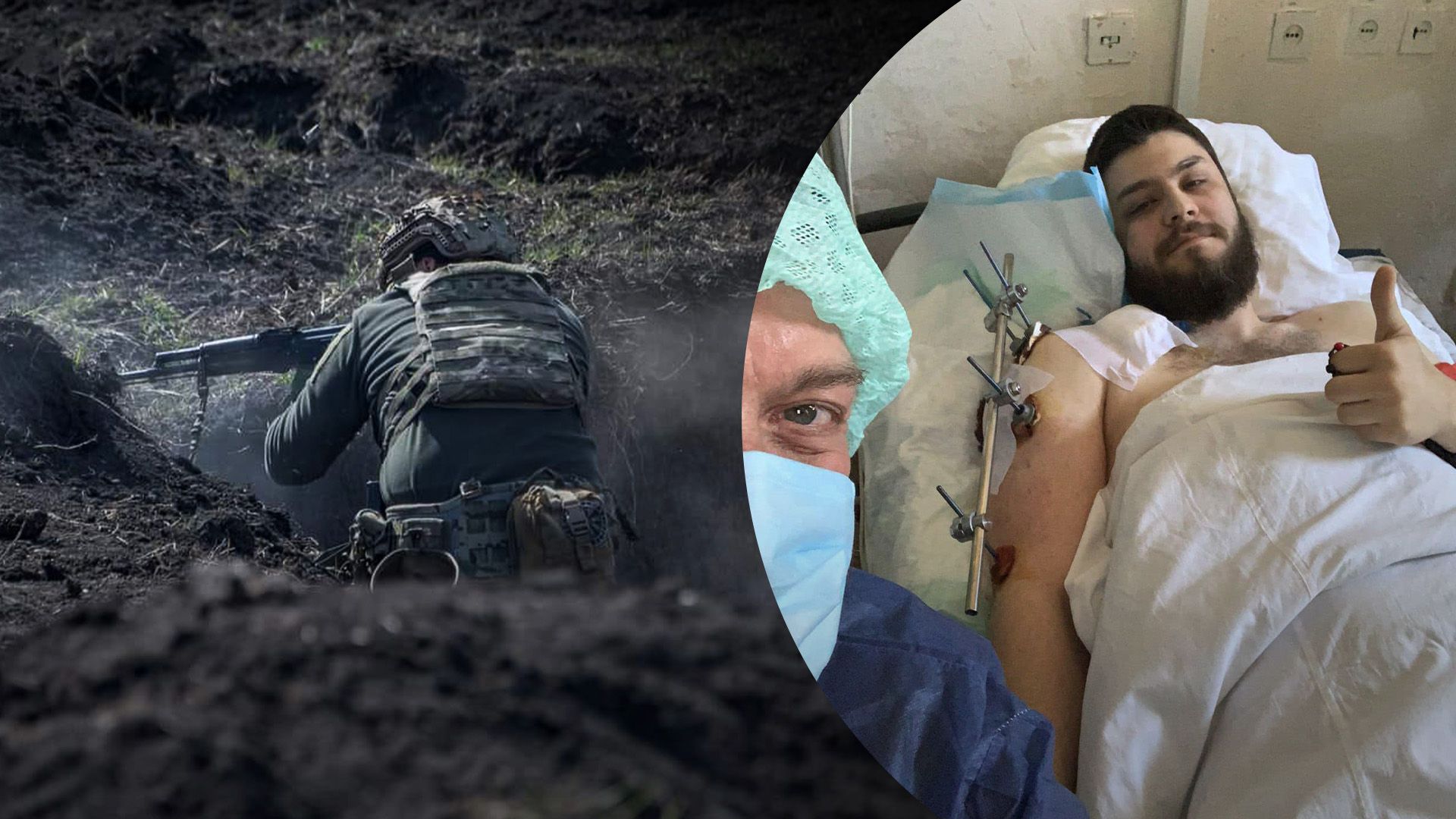 Сын Тягнибока получил ранение Сын Тягнибока получил ранение