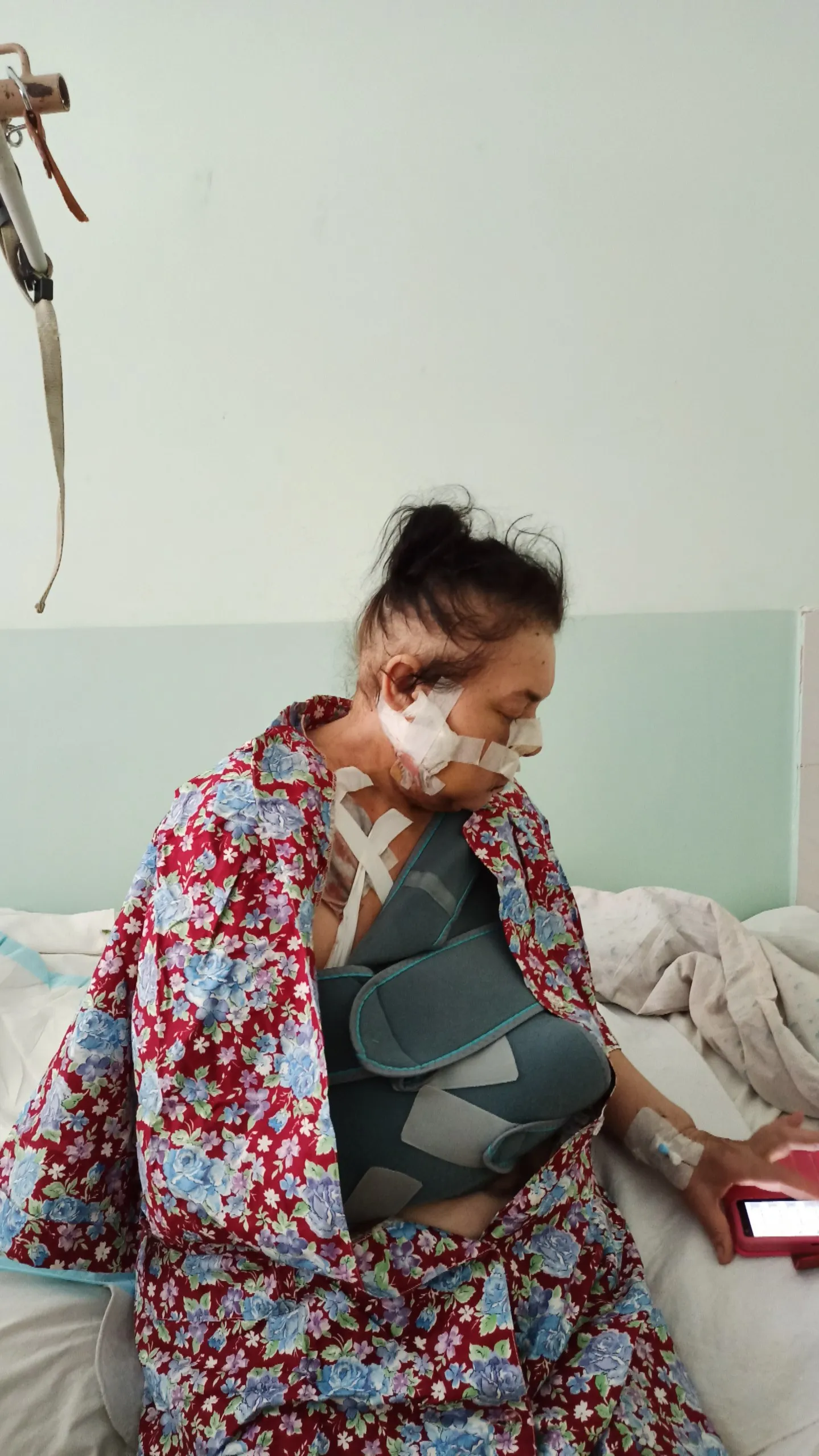 Пацієнтка після операції Пацієнтка після операції