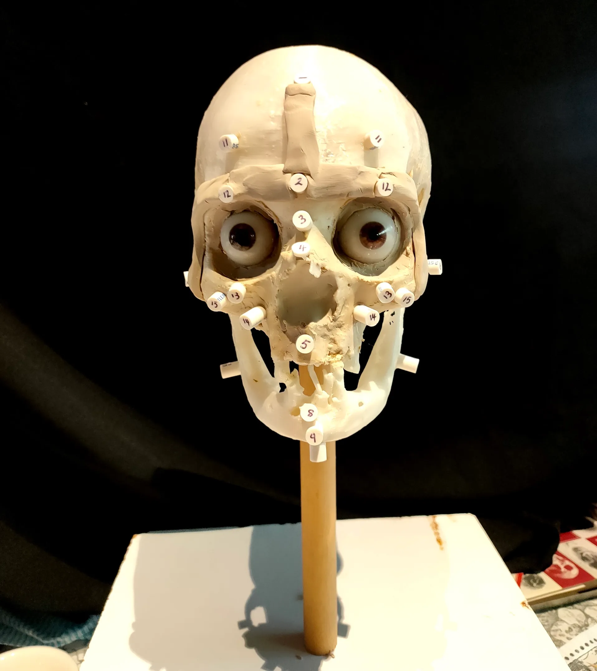 3D-печать черепа с маркерами глубины тканей на нем