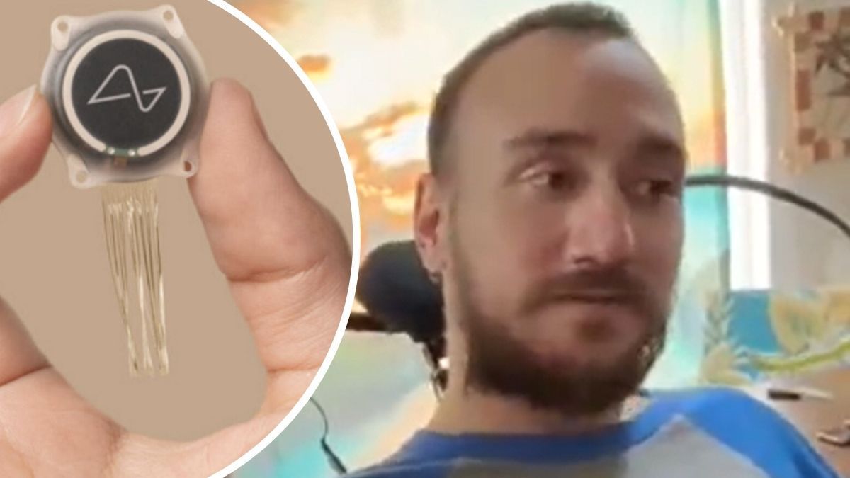 Ноланд Арбо Ноланд Арбо