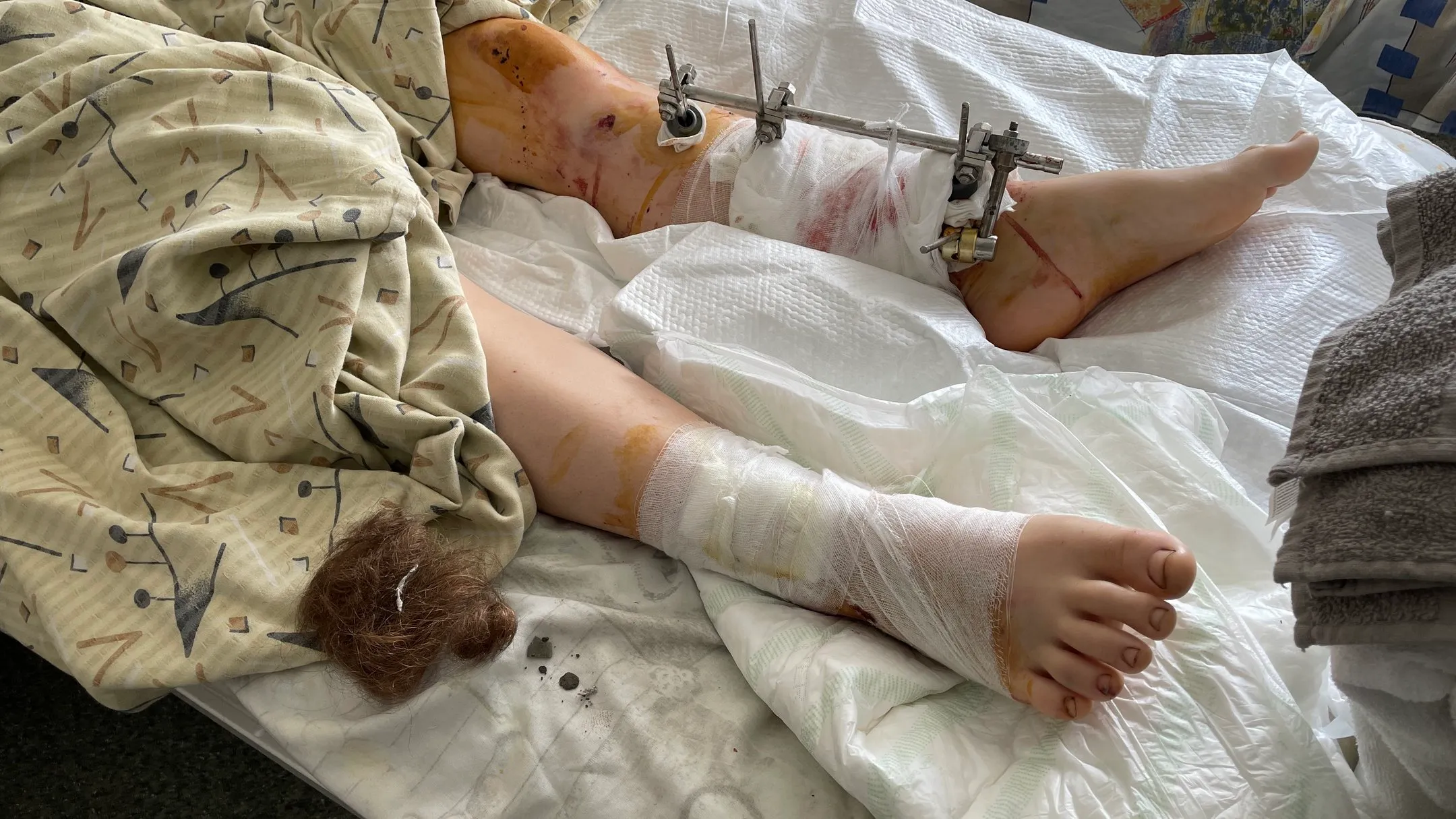 Атака по Черкасской Лозовой Атака по Черкасской Лозовой