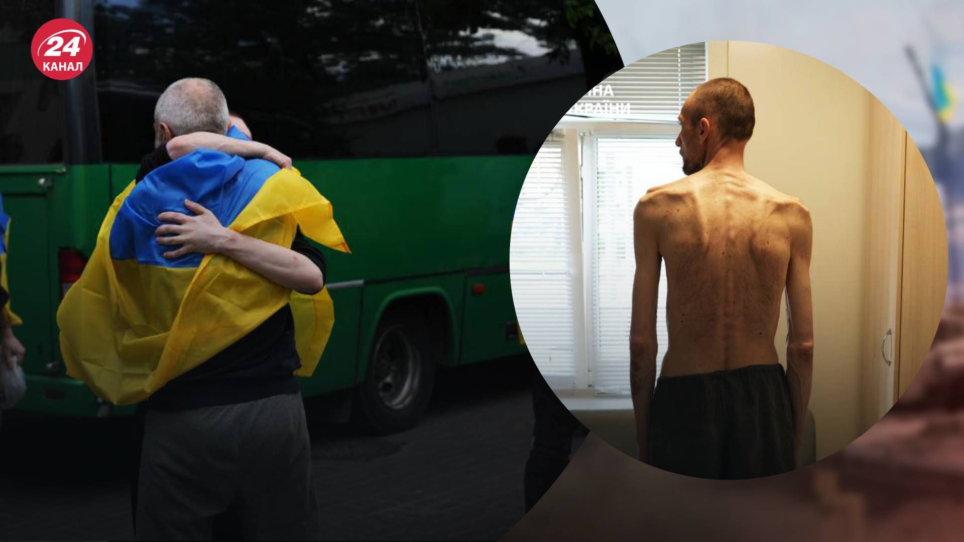 Украинцы в плену имеют болезни Украинцы в плену имеют болезни