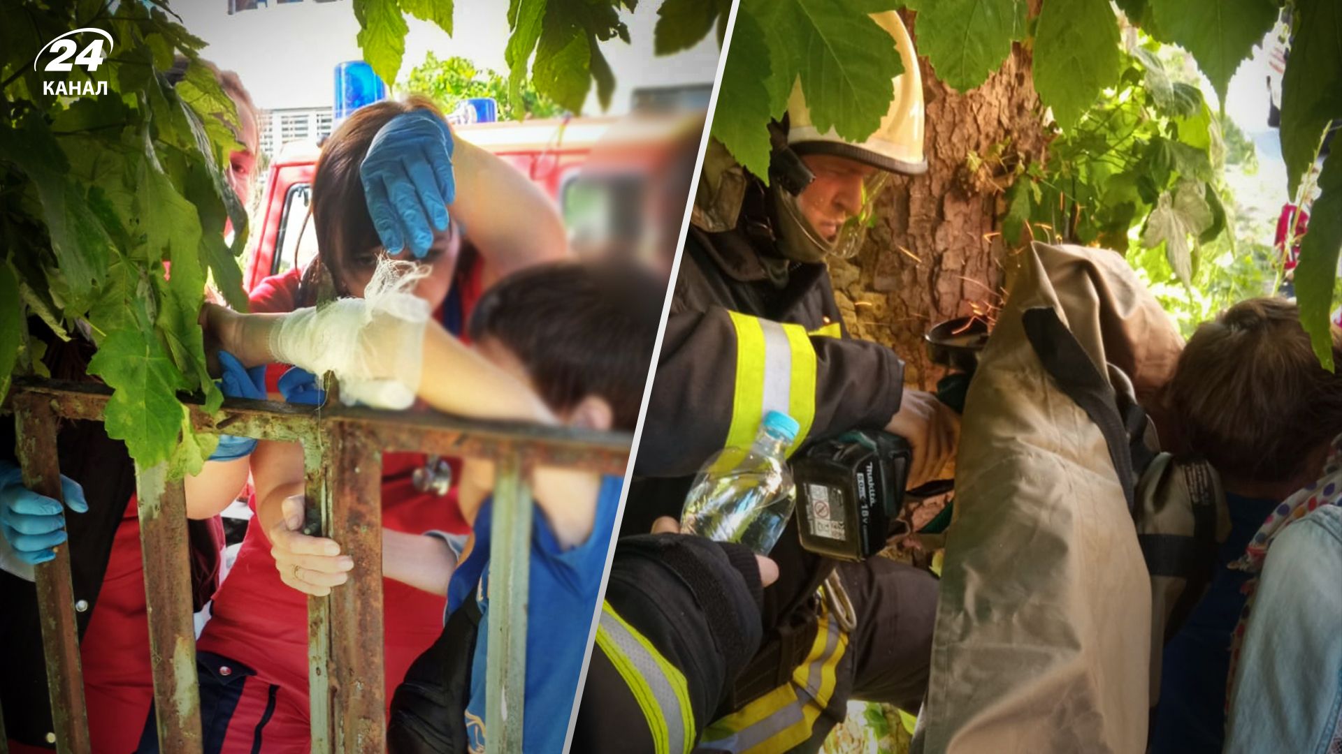 На Львовщине ребенок на спортплощадке пробил руку ограждением На Львовщине ребенок на спортплощадке пробил руку ограждением