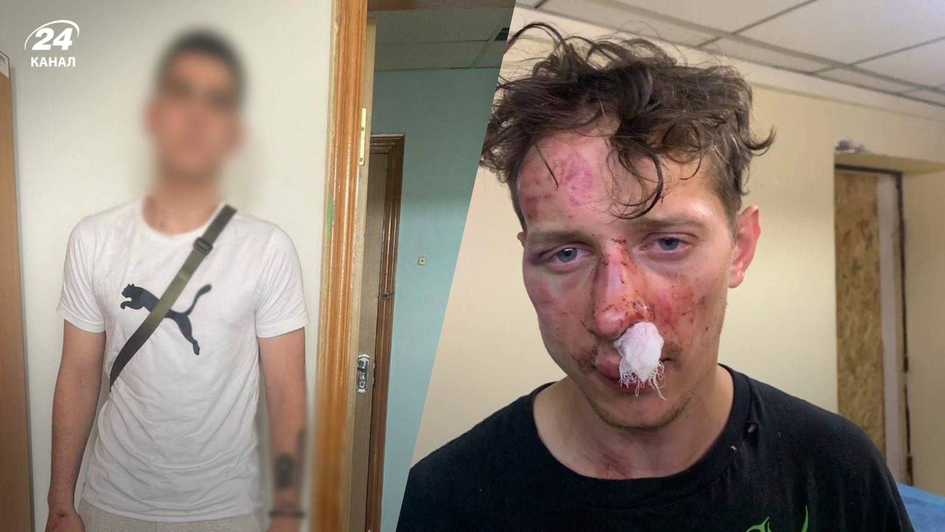 Нападение на бывшего военного в Киеве Нападение на бывшего военного в Киеве