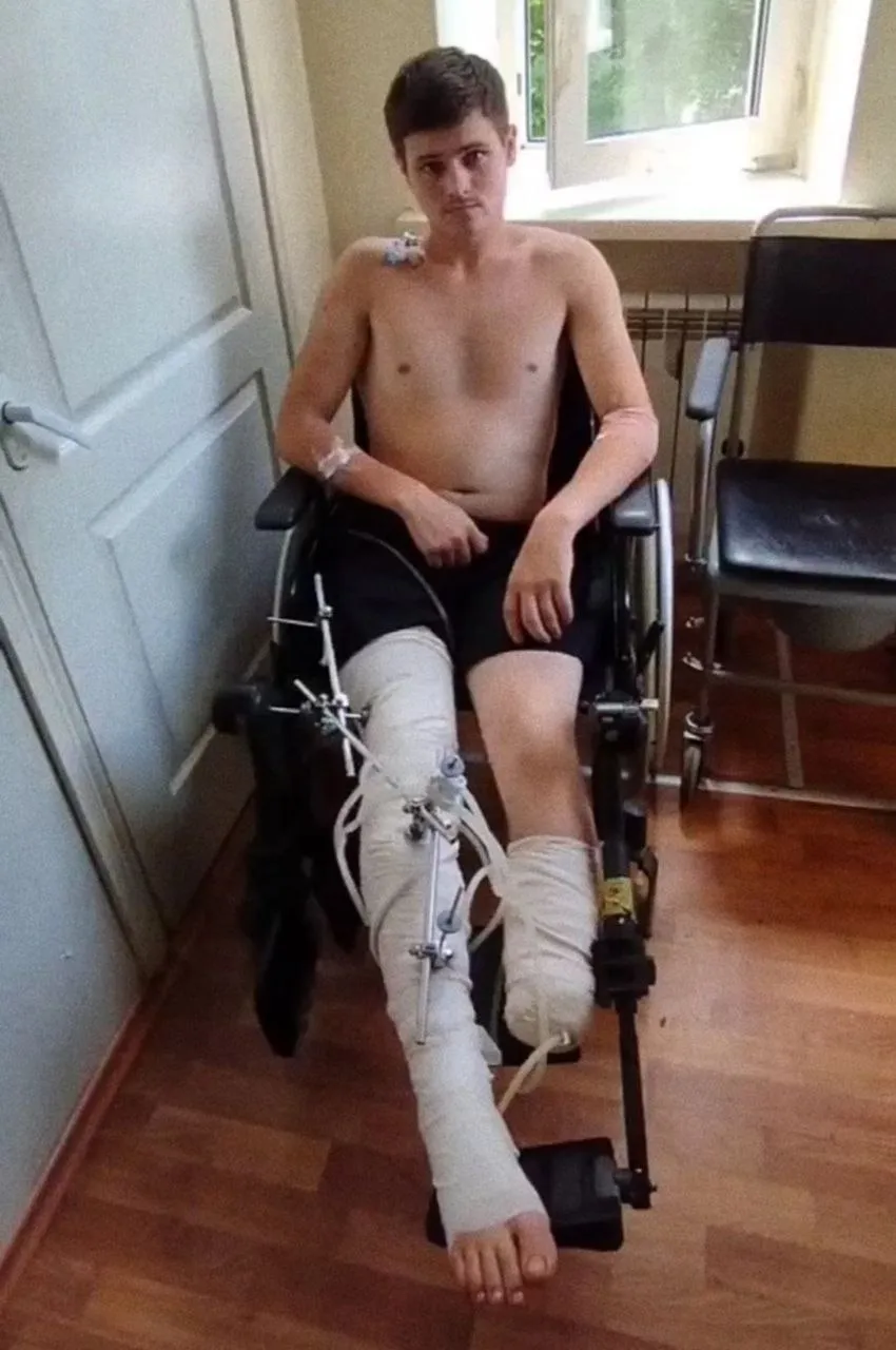 Военный потерял нижнюю конечность на войне против России Военный потерял нижнюю конечность на войне против России