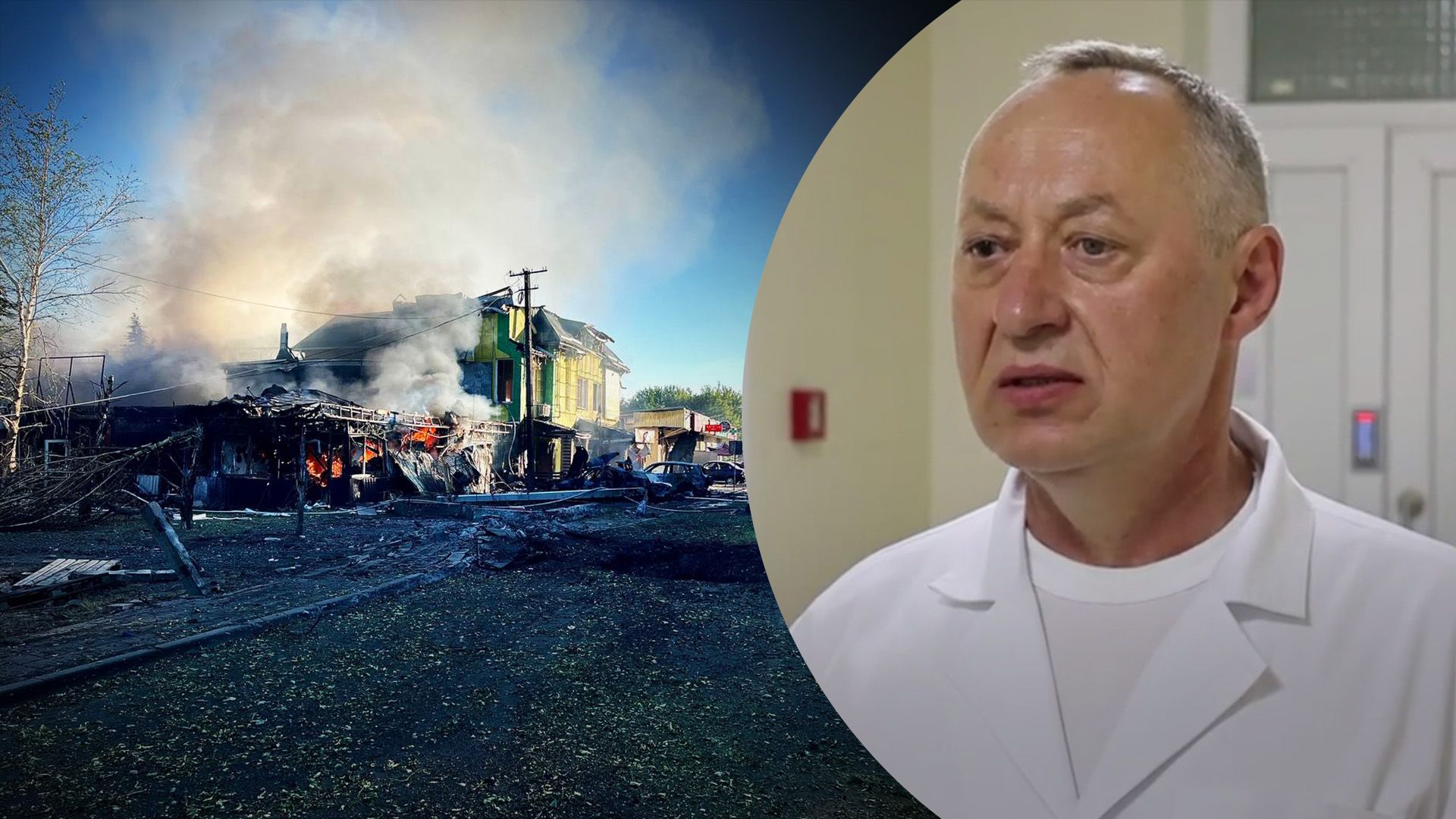 У якому стані поранені діти У якому стані поранені діти