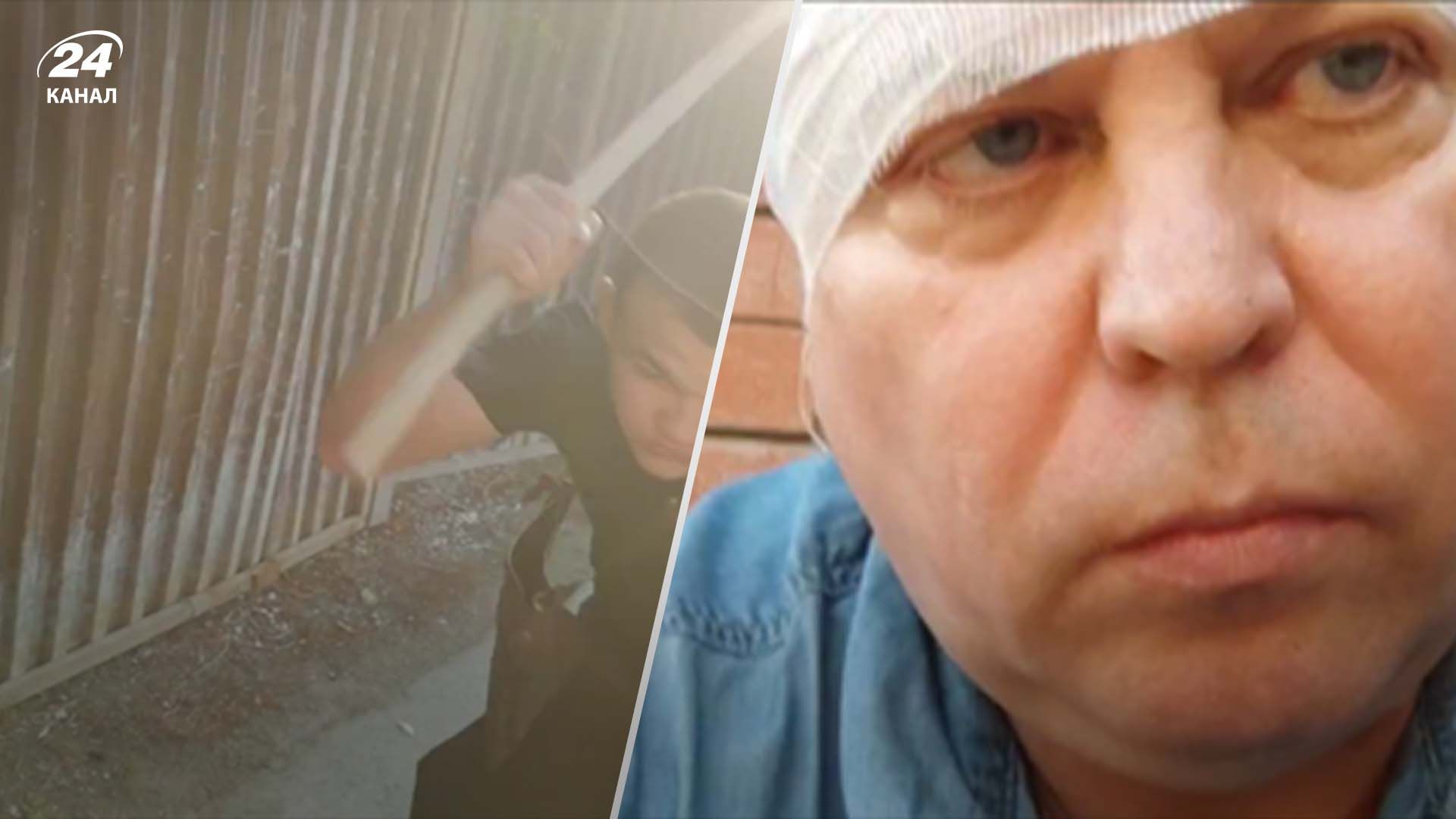 У Самарі мігранти розбили голову депутату держдуми Росії У Самарі мігранти розбили голову депутату держдуми Росії