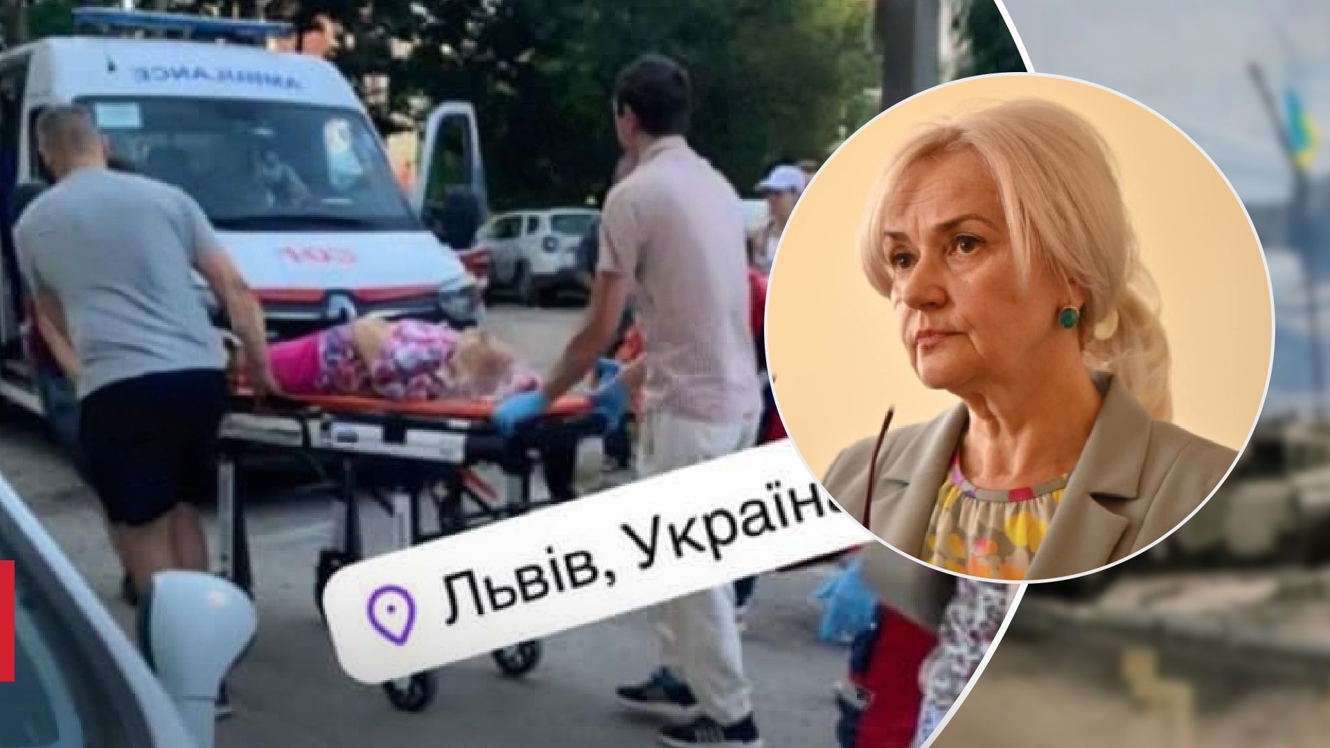 Глибока мозкова кома: Фаріон прооперували, в якому стані вона зараз - 24 Канал