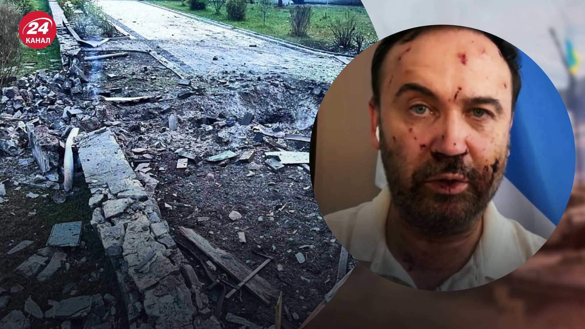 Пономарев получил ранения в результате ночной атаки - 24 Канал Пономарев получил ранения в результате ночной атаки - 24 Канал