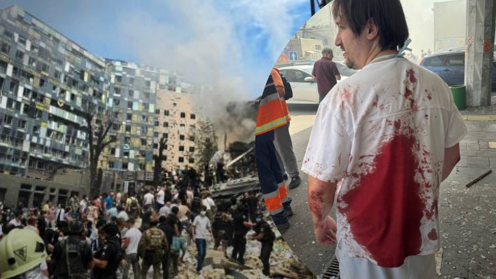 5 Его фото облетело весь мир: хирург "Охматдета" Олег Голубченко ответил на циничную пропаганду - 24 Канал 5 Его фото облетело весь мир: хирург "Охматдета" Олег Голубченко ответил на циничную пропаганду - 24 Канал