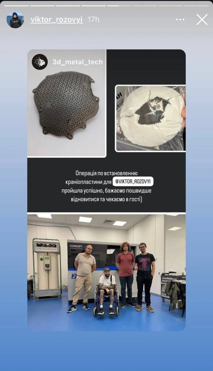 Віктор Розовий з людьми, які розробили титанічну пластину Віктор Розовий з людьми, які розробили титанічну пластину