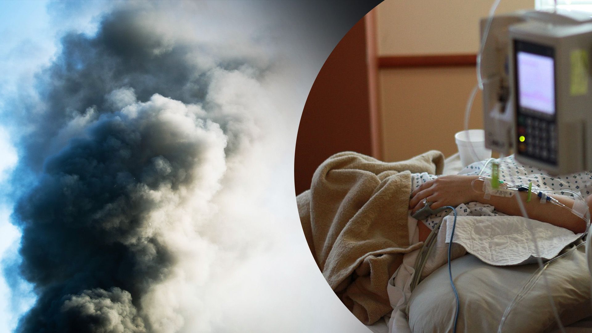 Россия обстреляла Казачью Лопань Россия обстреляла Казачью Лопань