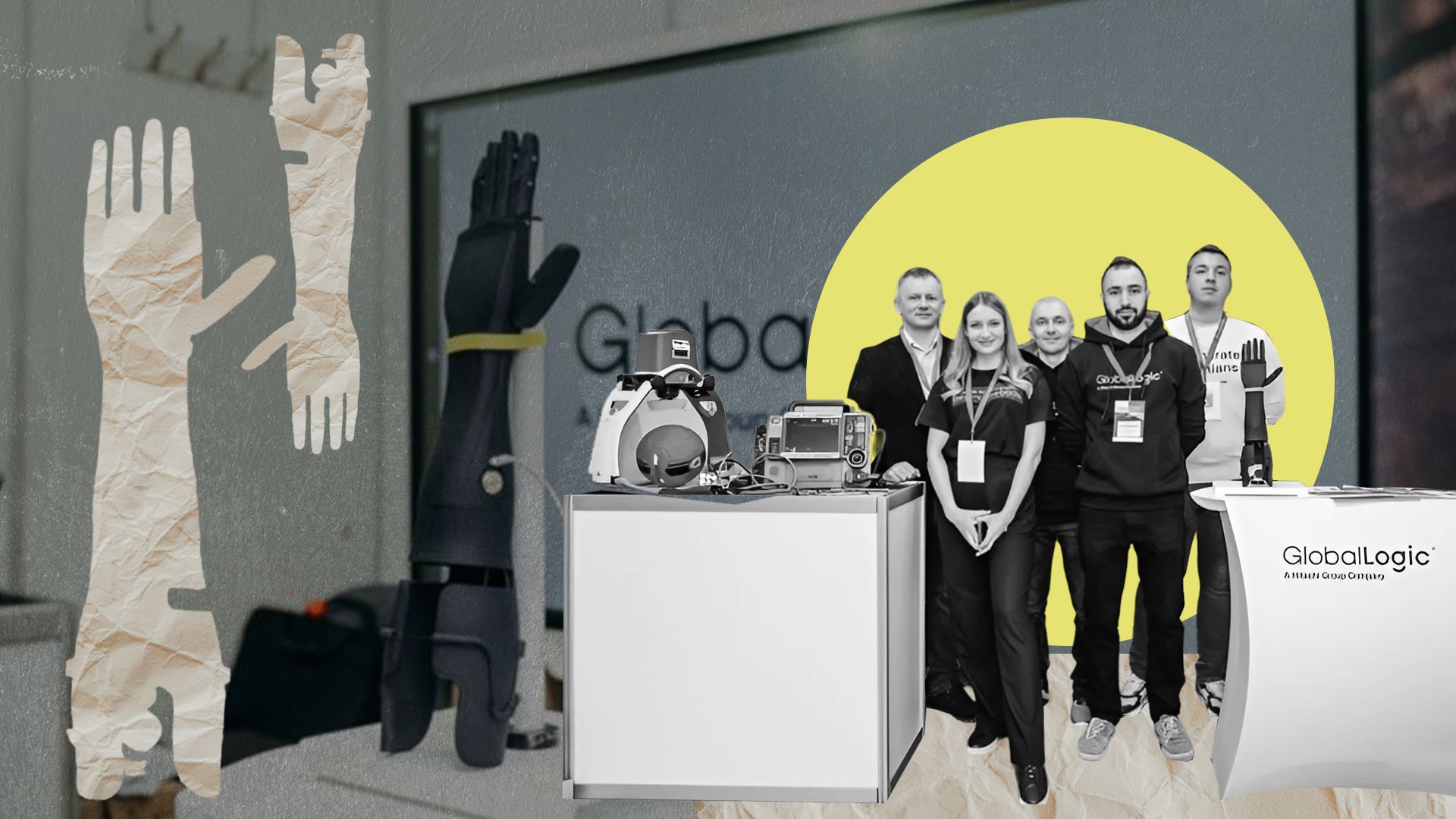 Бионические протезы в Украине - 24 Канал Бионические протезы в Украине - 24 Канал