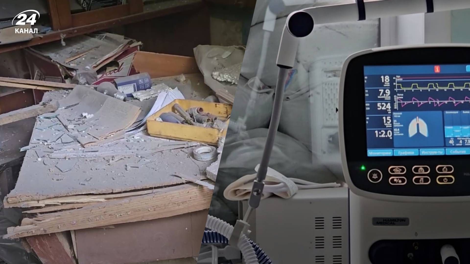 Довелося ампутувати частину руки: медики борються за життя 14-річної дівчинки з Херсона Довелося ампутувати частину руки: медики борються за життя 14-річної дівчинки з Херсона