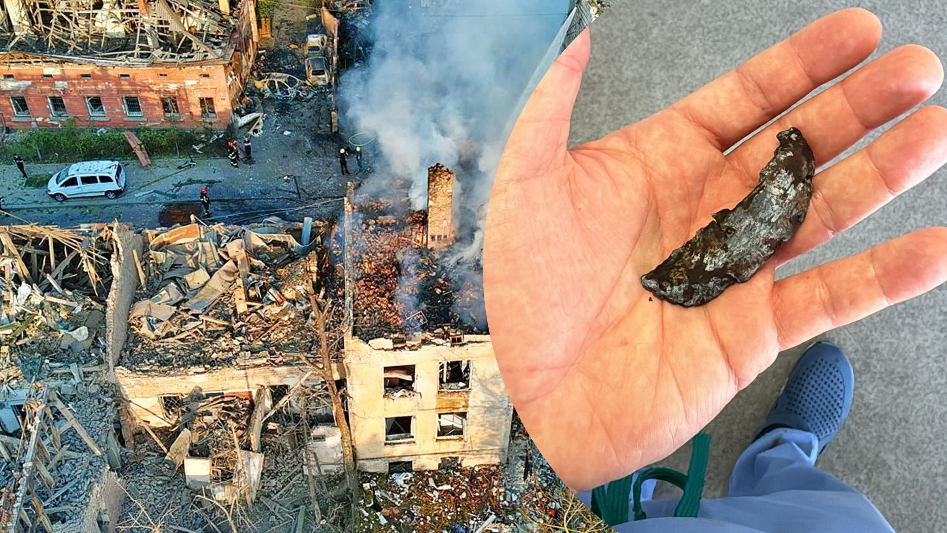 Удар по Львову: хирург показал фрагмент "Кинжала", который повредил органы одному из раненых - 24 Канал Удар по Львову: хирург показал фрагмент "Кинжала", который повредил органы одному из раненых - 24 Канал