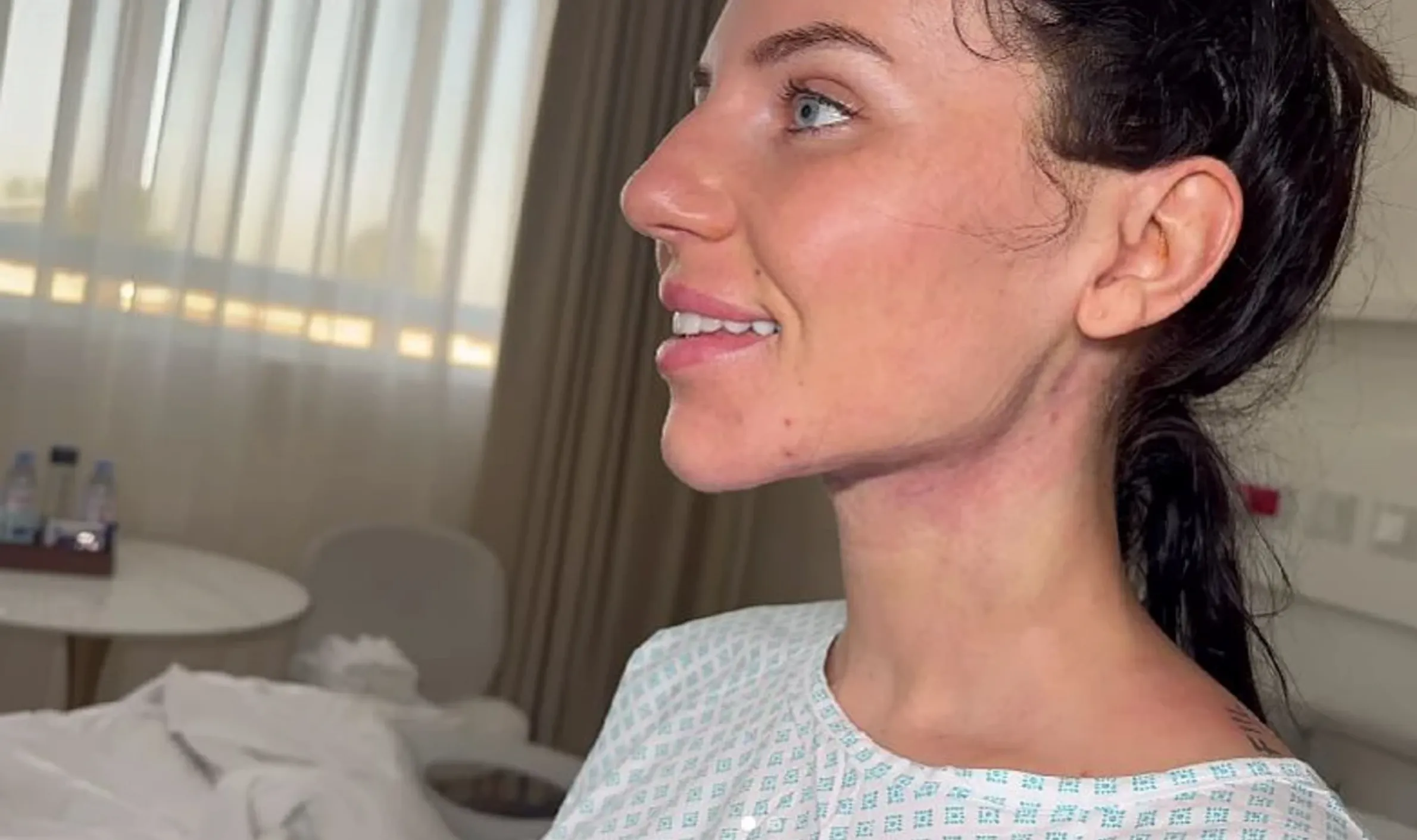 Анна Алхим после операции Анна Алхим после операции