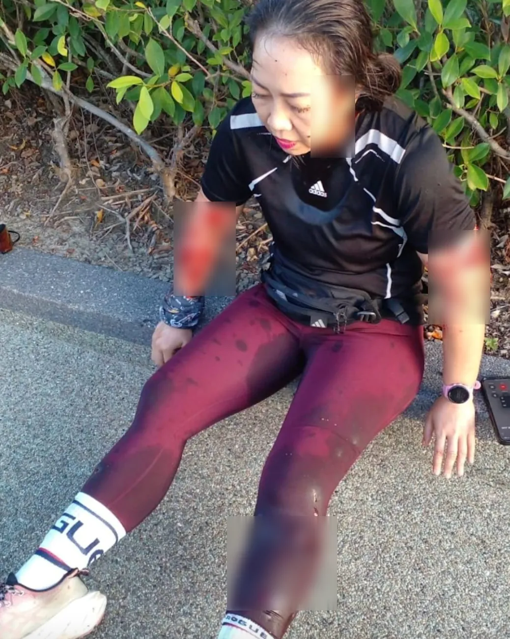 Девушку покусали выдры Девушку покусали выдры