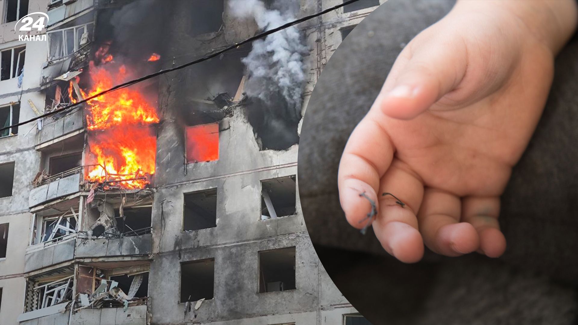 Серед постраждалих у Харкові були діти до 10 років Серед постраждалих у Харкові були діти до 10 років