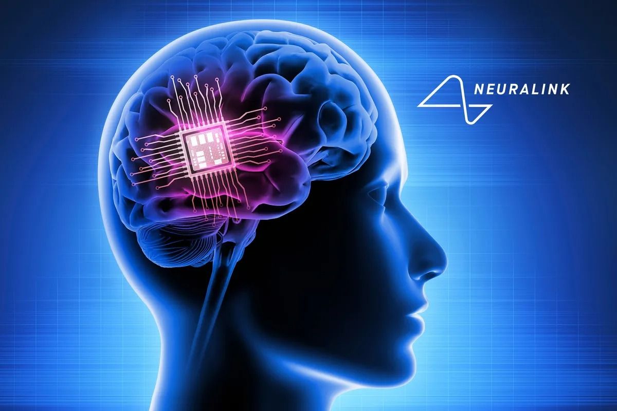 Вовий пристрій Neuralink подарує людям надлюдські можливості Вовий пристрій Neuralink подарує людям надлюдські можливості