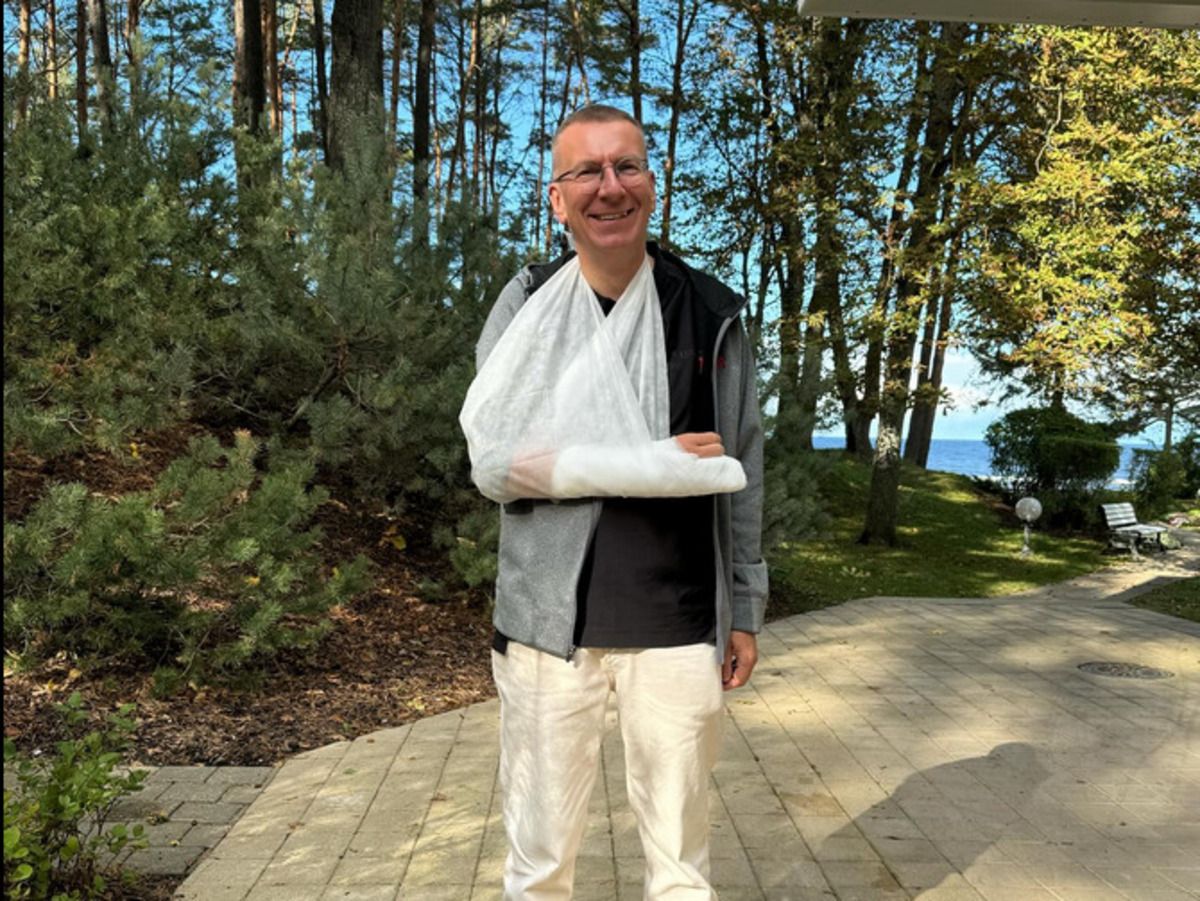 Президент Латвии травмировался во время падения с велосипеда Президент Латвии травмировался во время падения с велосипеда