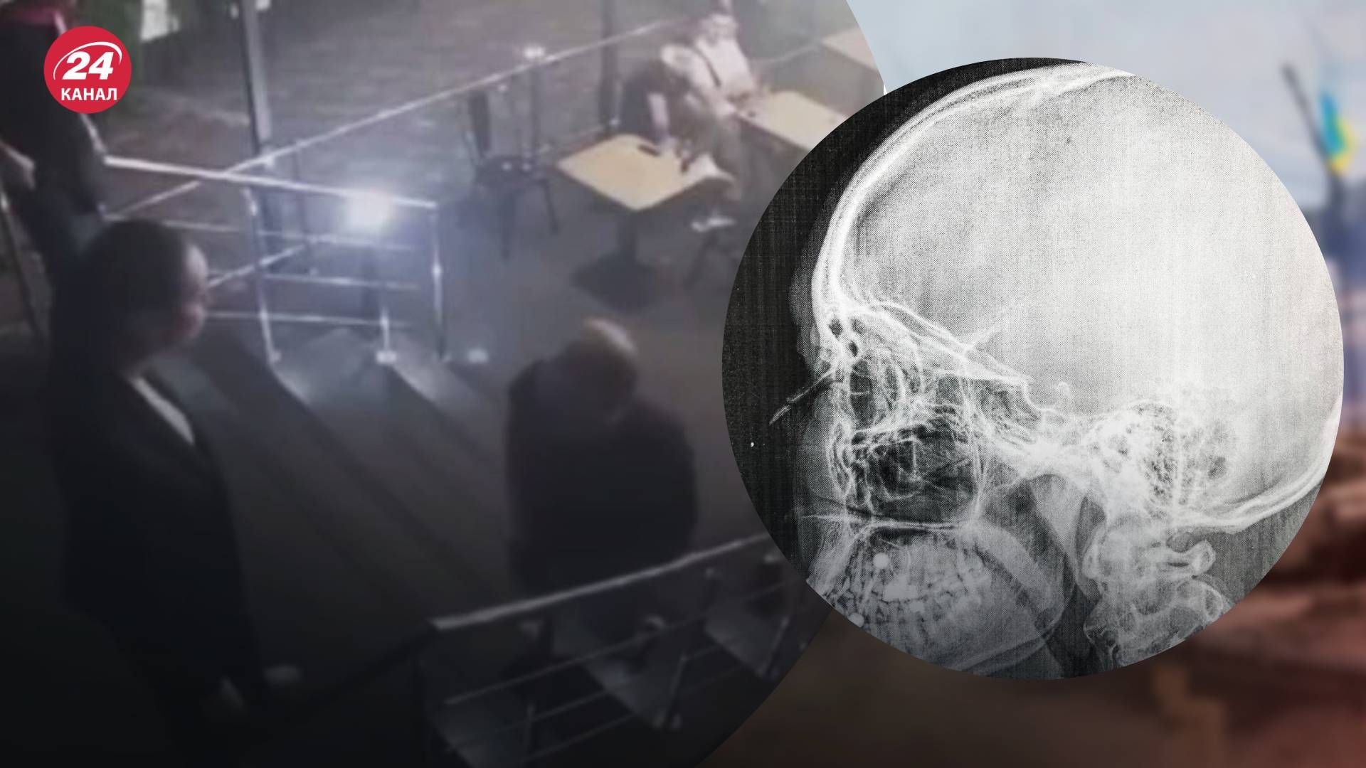 В Запорожье мужчина избил работницу бара - 24 Канал В Запорожье мужчина избил работницу бара - 24 Канал