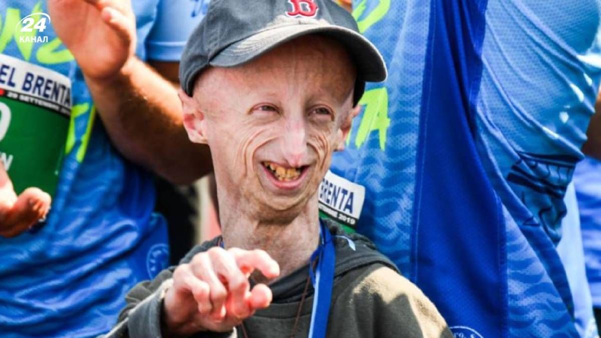 Помер відомий італійський учений із синдромом передчасного старіння
