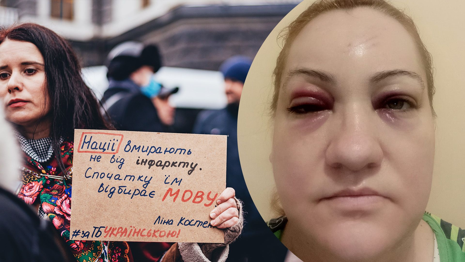 У Бучі чоловік напав на дружину загиблого захисника і її сина через мову, – адвокатка потерпілої - 24 Канал У Бучі чоловік напав на дружину загиблого захисника і її сина через мову, – адвокатка потерпілої - 24 Канал