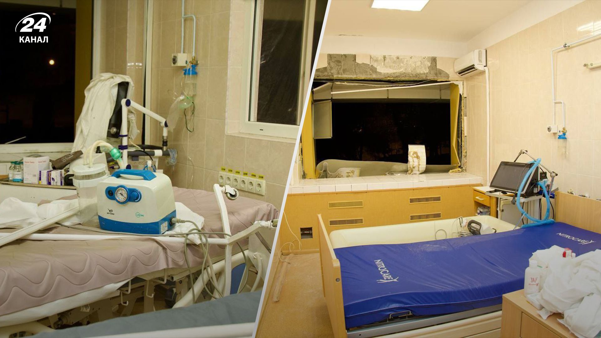 Нейрохирург проводил операцию во время обстрела в Днепре Нейрохирург проводил операцию во время обстрела в Днепре