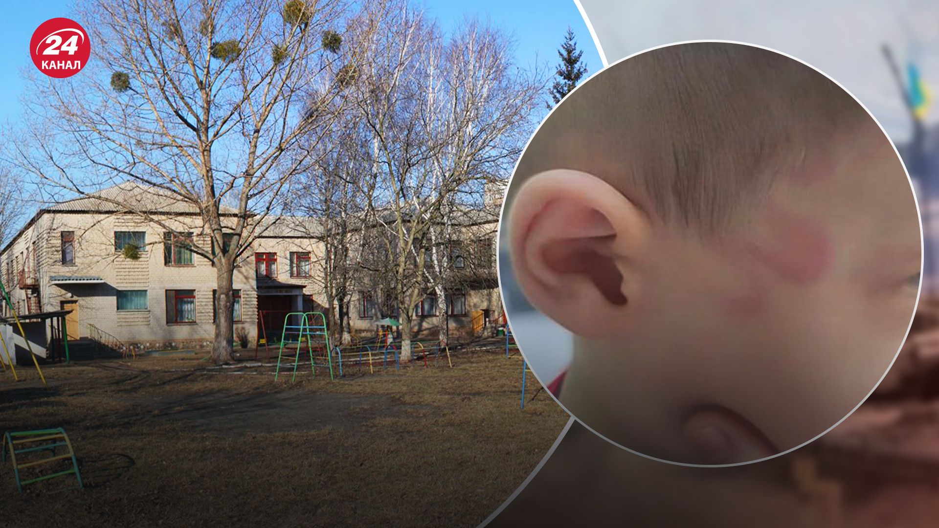 У Кіровоградській області завершили розслідування щодо побиття дитини у дитсадку У Кіровоградській області завершили розслідування щодо побиття дитини у дитсадку