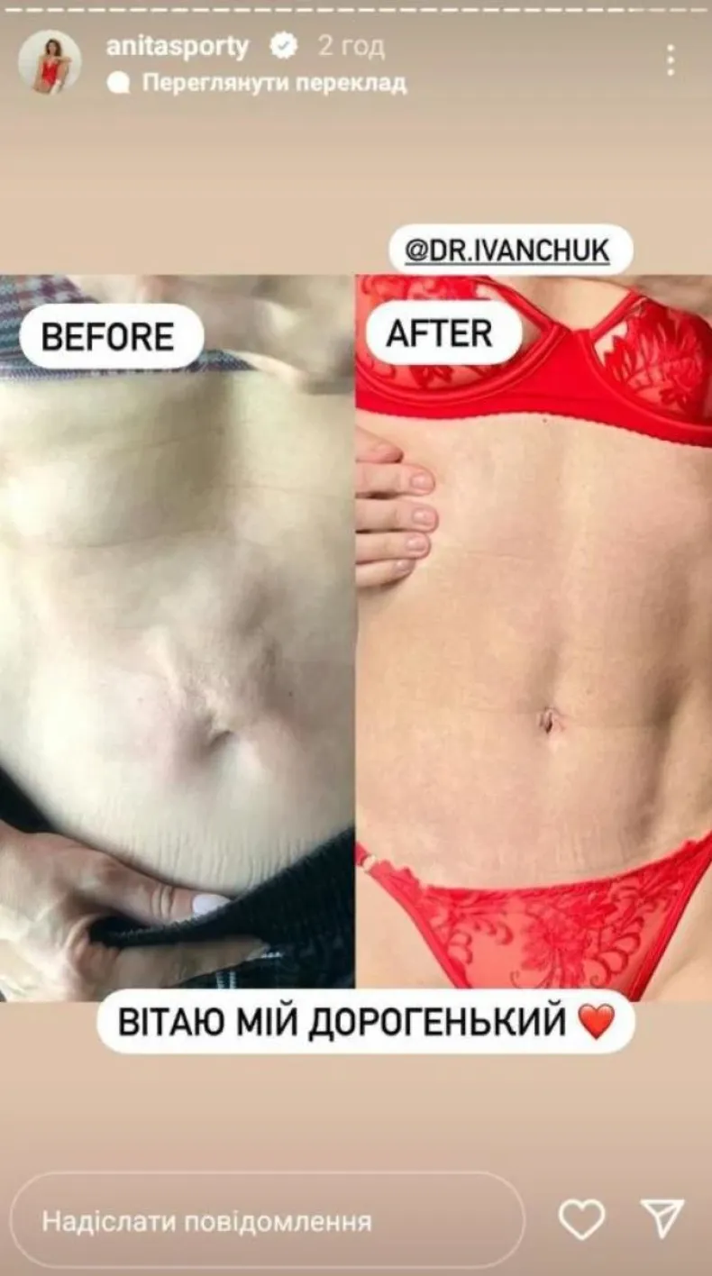 Аніта Луценко розповіла про операцію Аніта Луценко розповіла про операцію