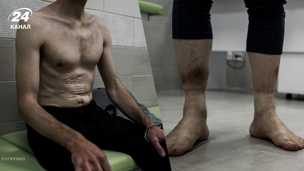 Який вигляд мають азовці після повернення з російського полону Який вигляд мають азовці після повернення з російського полону