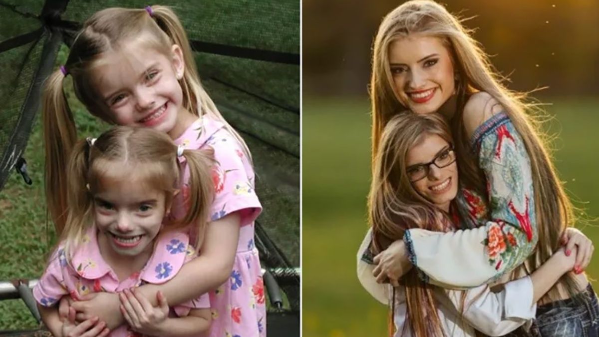 Сестры-близняшки побили 2 мировых рекорда - в чем их уникальность Сестры-близняшки побили 2 мировых рекорда - в чем их уникальность