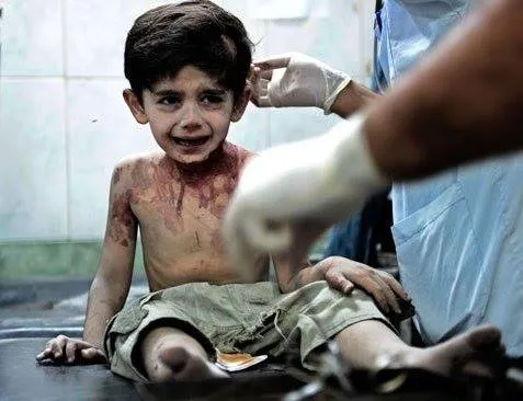 Мальчик из Алеппо Мальчик из Алеппо