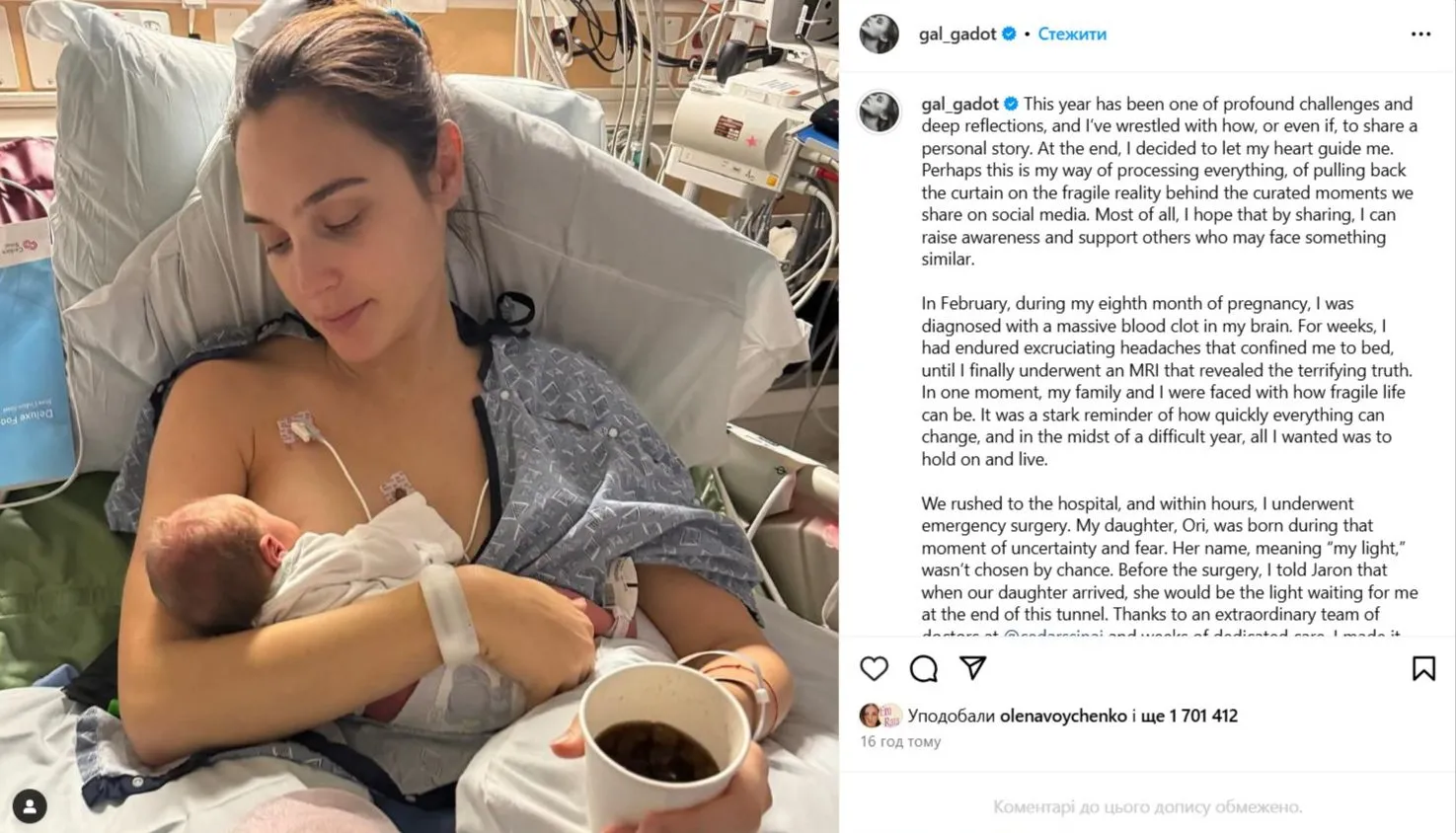 Галь Гадот о своем диагнозе Галь Гадот о своем диагнозе