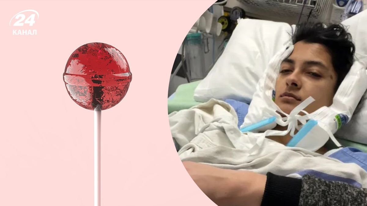 Дівчинавідкусила цукерку і потрапила до лікарні - вона зламала щелепу у двох місцях Дівчинавідкусила цукерку і потрапила до лікарні - вона зламала щелепу у двох місцях