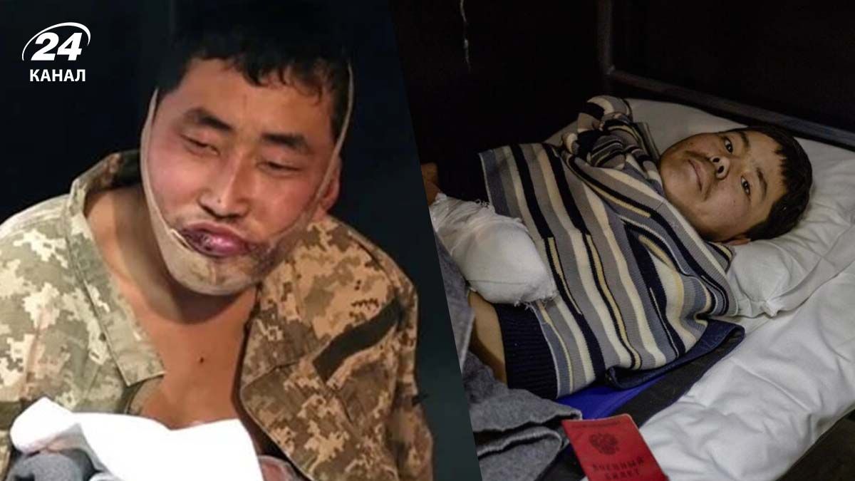 Солдати КНДР у полоні ЗСУ – які це може мати неприємні наслідки для Росії - 24 Канал Солдати КНДР у полоні ЗСУ – які це може мати неприємні наслідки для Росії - 24 Канал