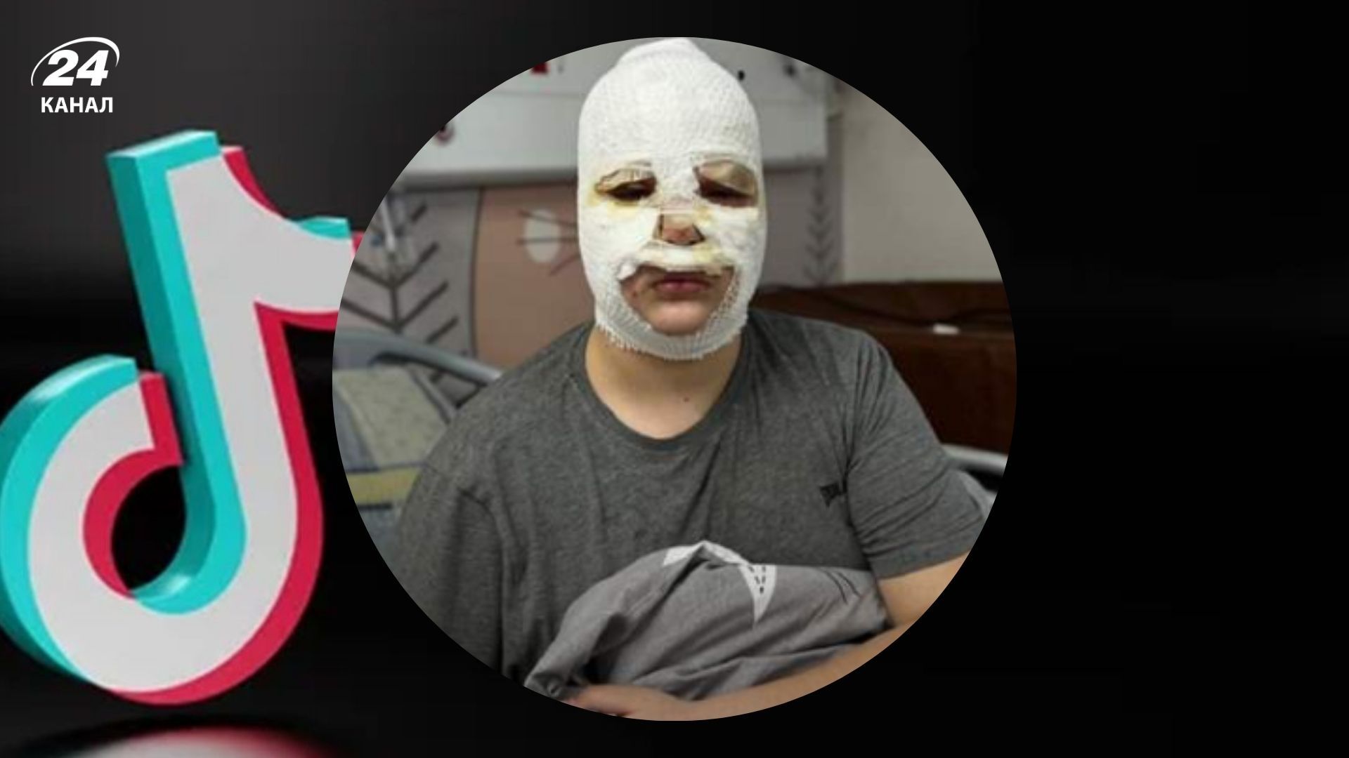 У Львові діти зазнали серйозних поранень через відео з TikTok У Львові діти зазнали серйозних поранень через відео з TikTok