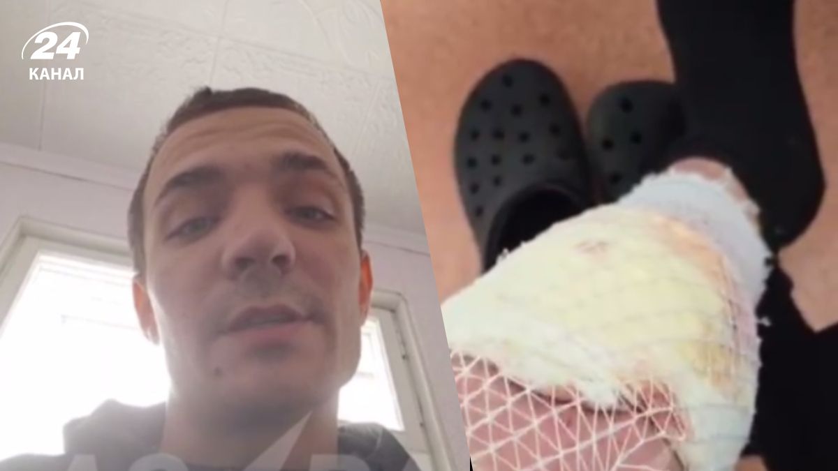 Заразили гепатитом, а після скарг відправили на війну: історія окупанта з гниючою ногою - 24 Канал Заразили гепатитом, а після скарг відправили на війну: історія окупанта з гниючою ногою - 24 Канал