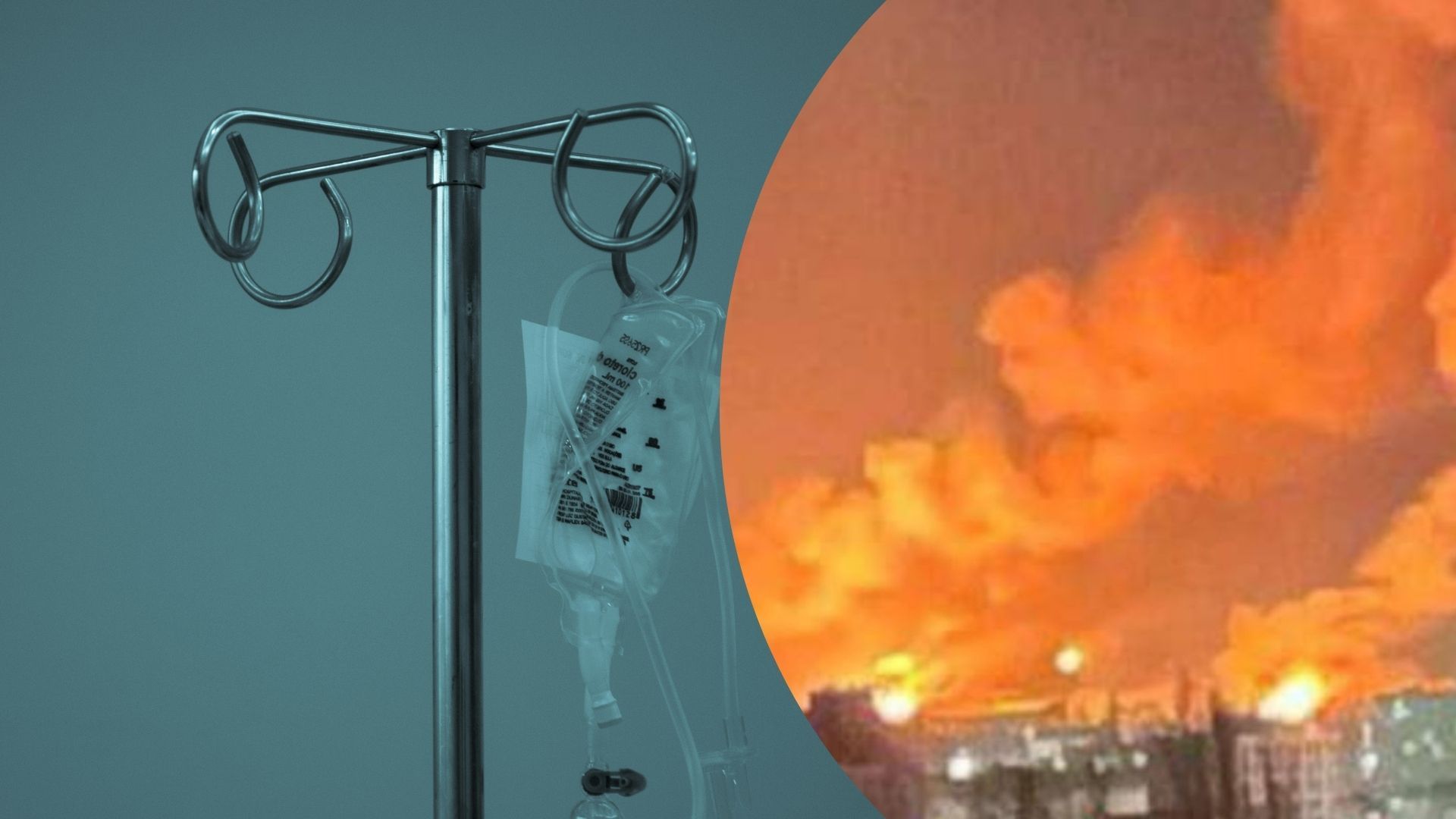 В якому стані чоловік з майже 90% опіків після атаки по Кропивницькому - 24 Канал В якому стані чоловік з майже 90% опіків після атаки по Кропивницькому - 24 Канал