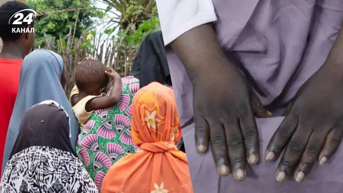 Дети стали жертвами жестокого отбеливания кожи из-за стремления матери к идеалу красоты - 24 Канал Дети стали жертвами жестокого отбеливания кожи из-за стремления матери к идеалу красоты - 24 Канал