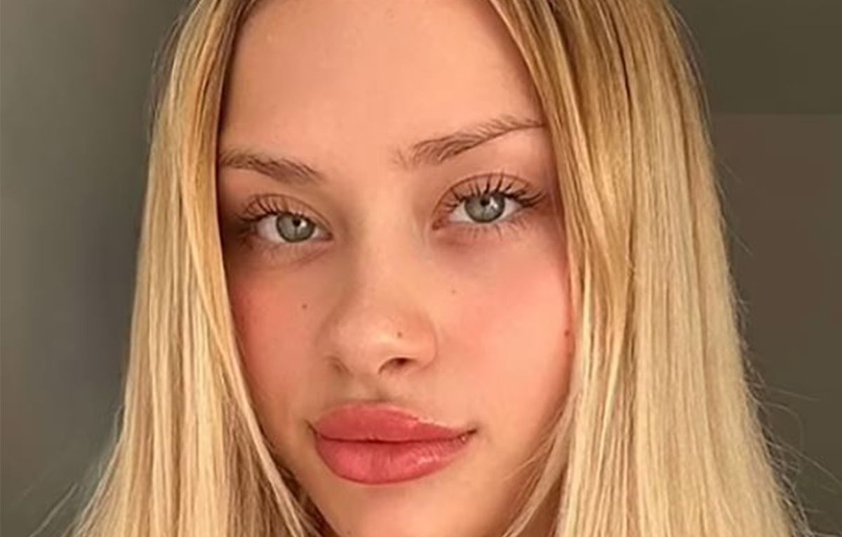 Модель Only Fans Марія Ковальчук опритомніла після побиття в Дубаї, - Daily Mail - 24 Канал Модель Only Fans Марія Ковальчук опритомніла після побиття в Дубаї, - Daily Mail - 24 Канал