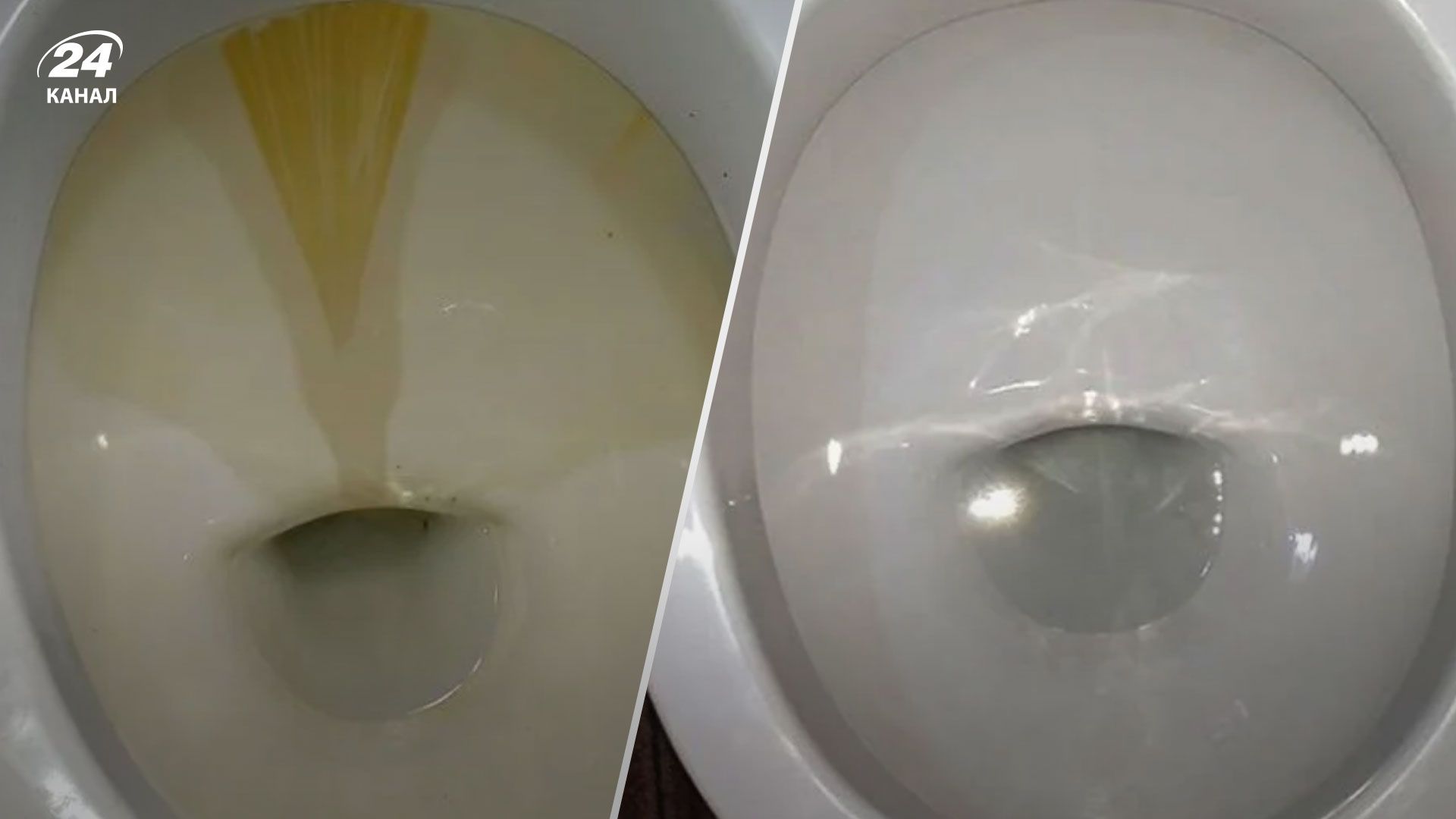 Водний камінь в унітазі Водний камінь в унітазі