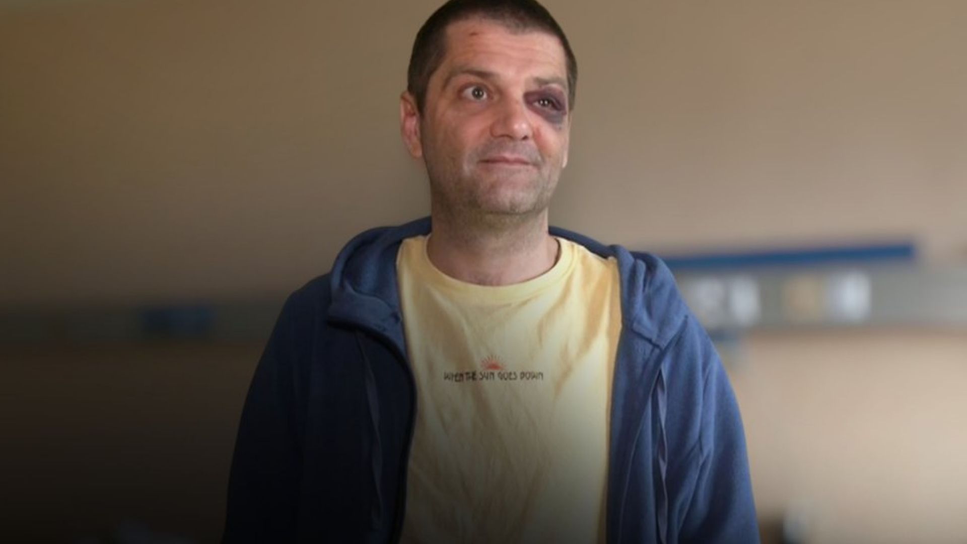 Работника ТЦК Нестора Дыдыка избили в Новом Роздоле