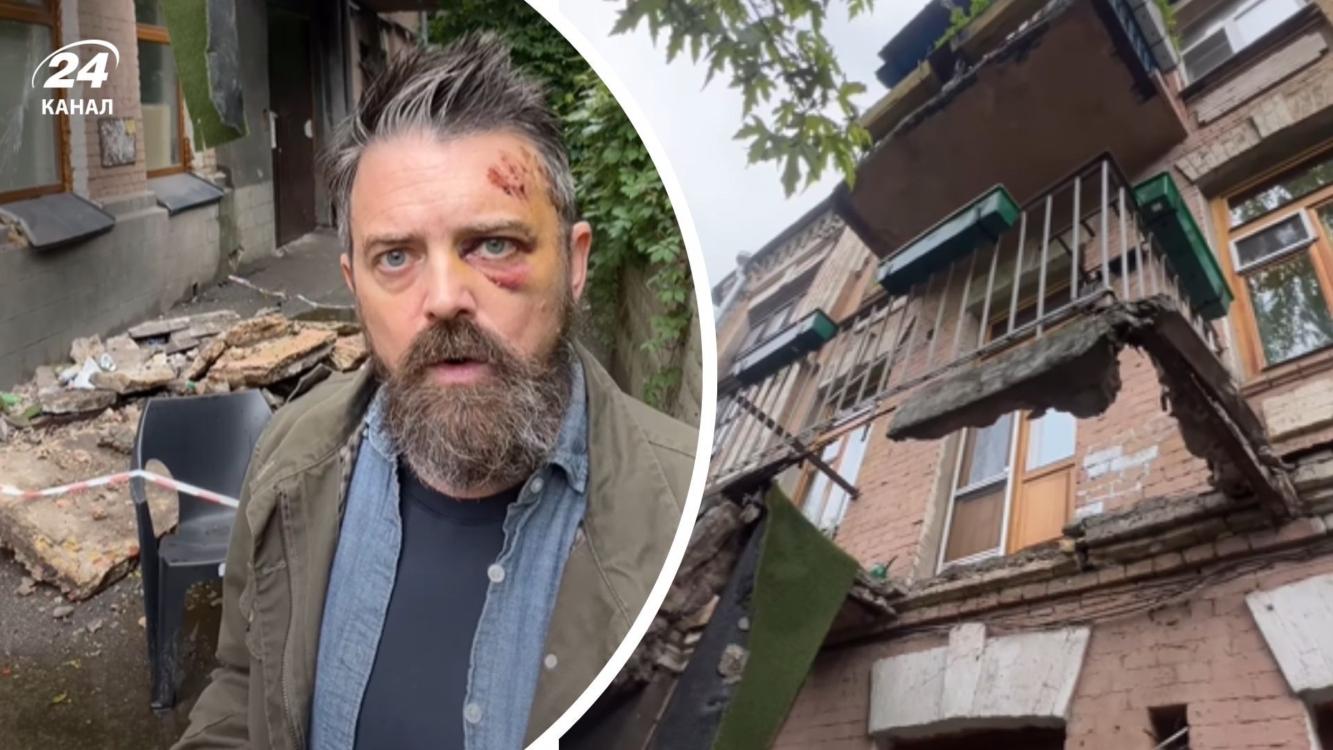 В КГГА прокомментировали обвал балкона жилого дома В КГГА прокомментировали обвал балкона жилого дома