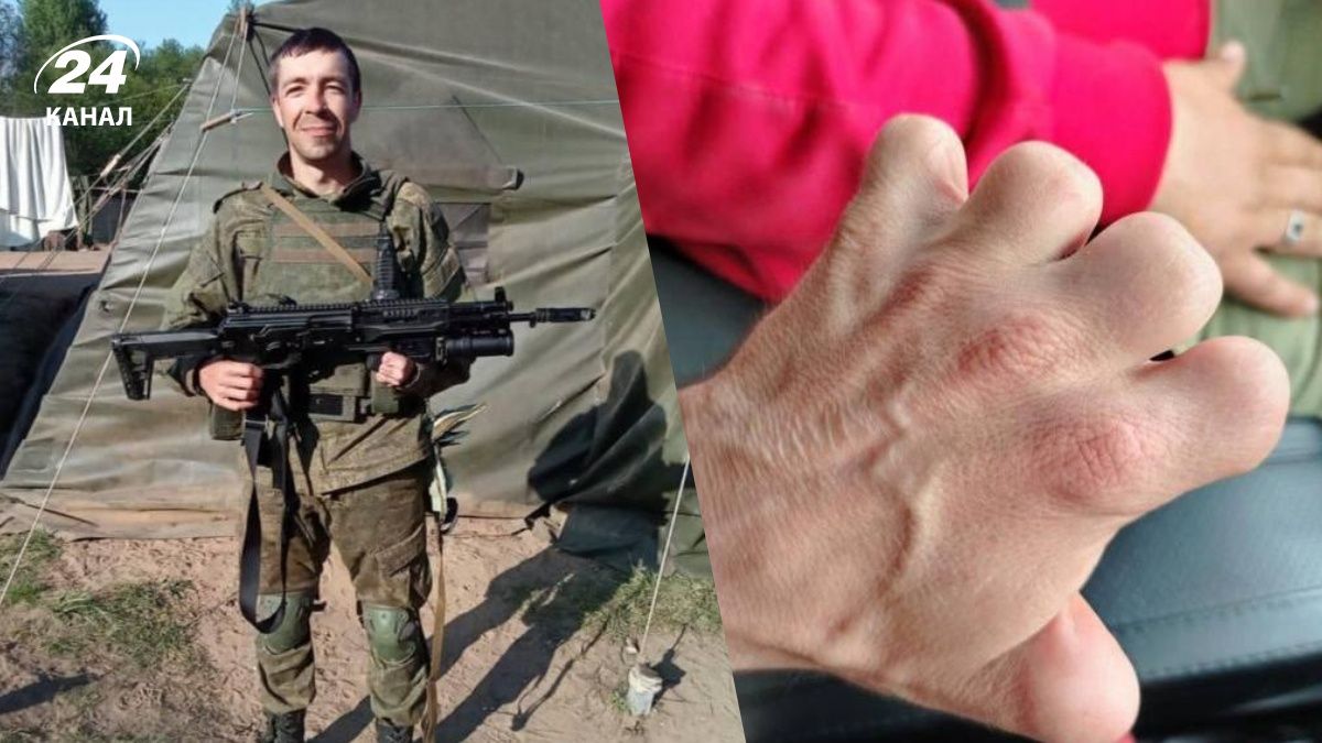 Россияне отправили на передовую контрактника без пальцев